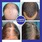 LIMETOW™ ORGANIC HAIR SERUM ROLLER (BUY 2 GET 1 FREE)