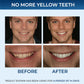 LIMETOW™ Bandes de blanchiment des dents 5D